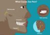 Tooth Pain: Causes, Symptoms, and Treatment Tooth Pain: Causes, Symptoms, and Treatment