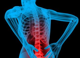 The Causes of Back Pain and How to Relieve It Without Surgery Back Pain