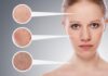 5 Different Types Of Skin Problems For You To Know Skin Problems