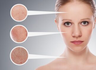 Skin Problems