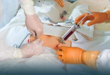 Bone Marrow Transplant