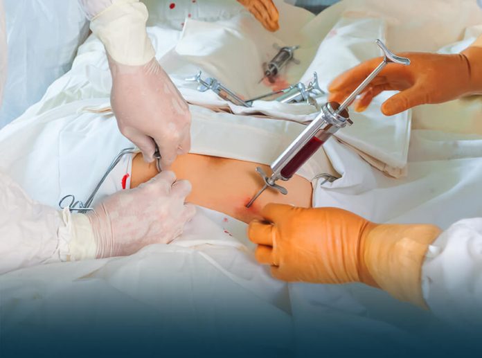 Bone Marrow Transplant