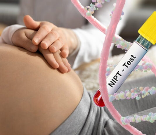 NIPT Lab Test