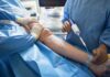 Preparing for a Fistula Operation Before Starting Dialysis Fistula Operation For Dialysis