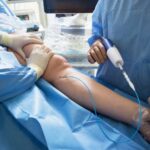 Fistula Operation For Dialysis