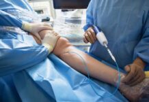 Fistula Operation For Dialysis