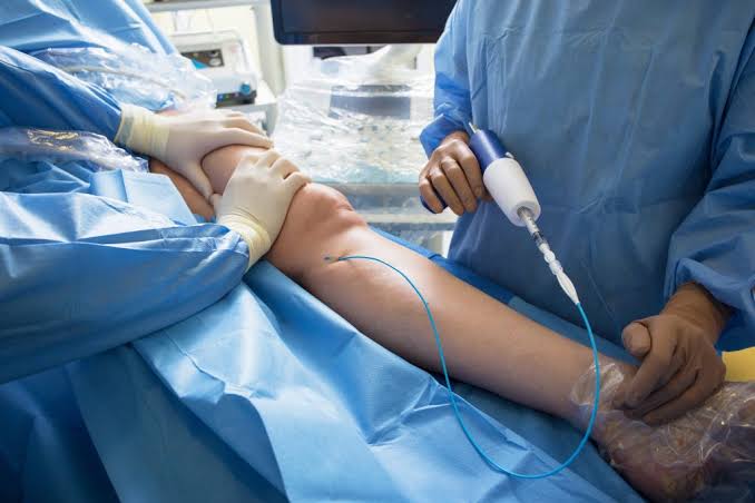 Varicose Vein Which Doctor To See Fistula Operation For Dialysis